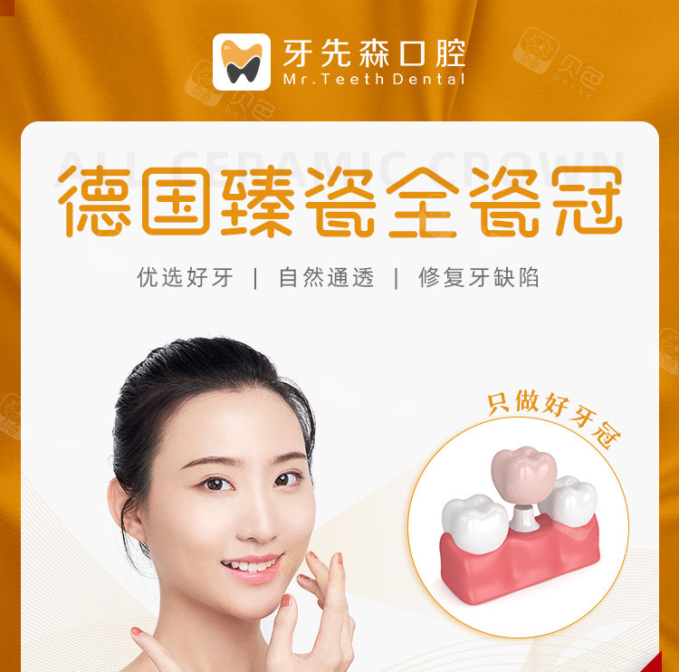 全冠牙德国威兰德二氧化锆牙冠 全瓷冠二氧化锆全瓷牙烤瓷牙牙齿美容冠 成都牙先森口腔 大丰店 贝色口腔