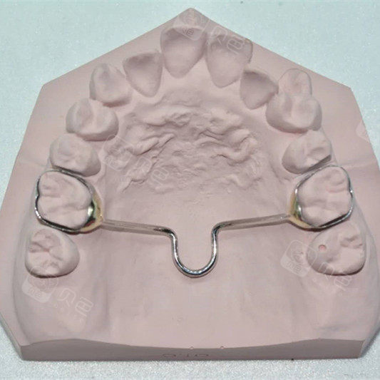 分享带横腭杆的感受给大家