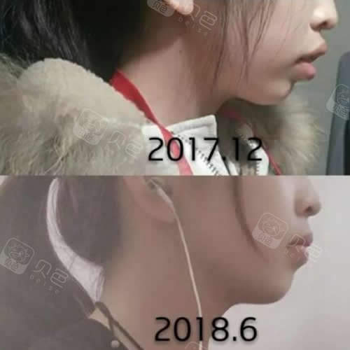 宜宾做龅牙矫正费用公开,这几家口腔正畸更受欢迎!