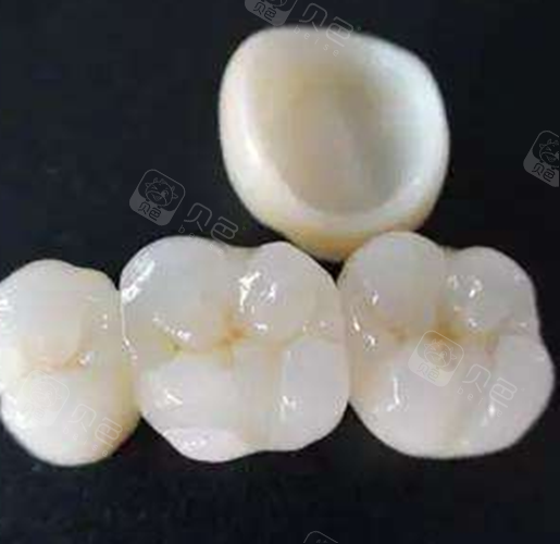保定烤瓷牙价格及计算收费的方式是什么样的公式?