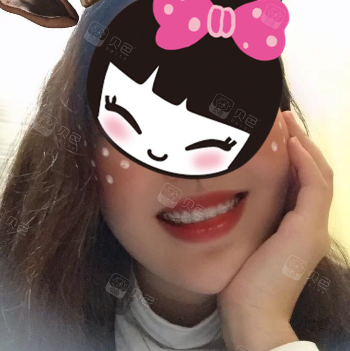 为什么有的人牙齿本来整整齐齐的,后来越长越歪?