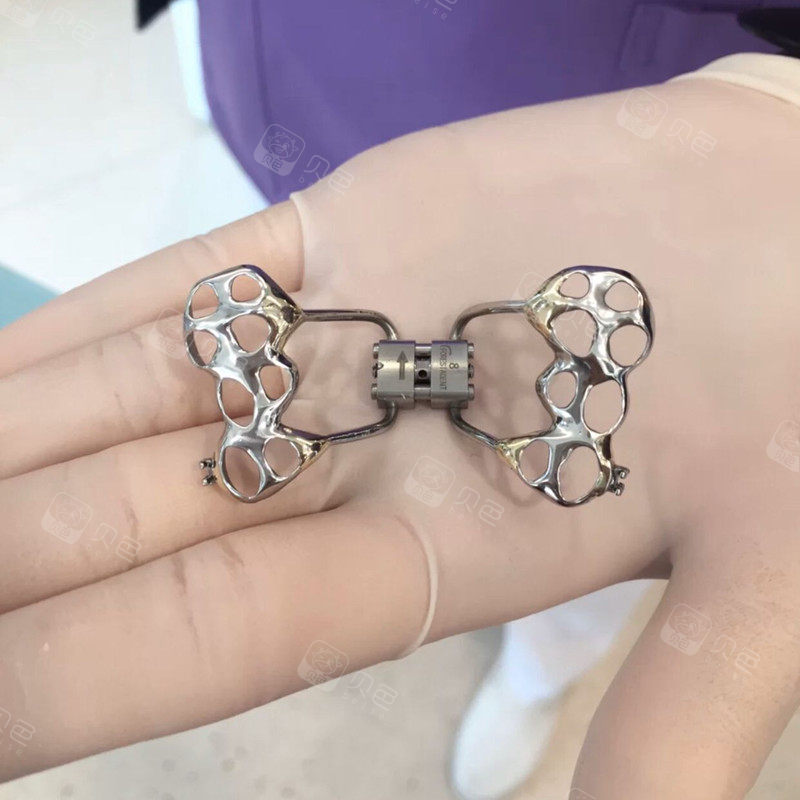 逛社区 >  牙友讨论 >  详细页面参考金额  0元 口腔项目  牙齿矫正