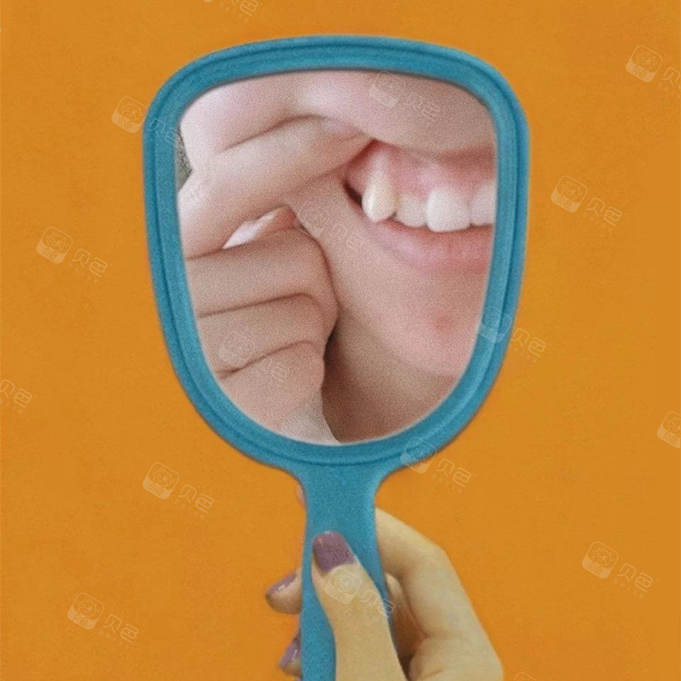 这样的价格算不算贵呢我做的传统陶瓷牙套