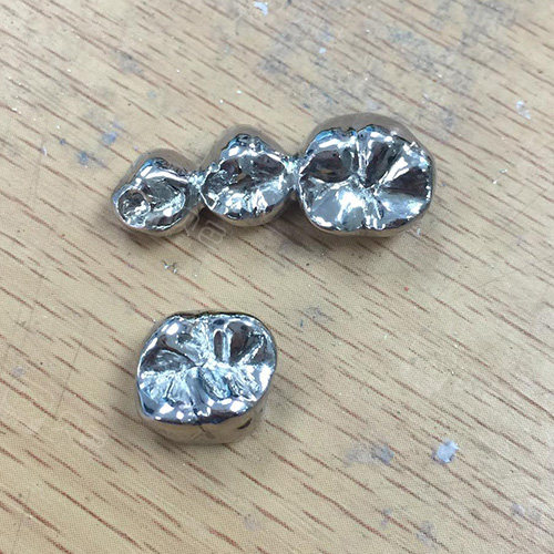 金属连桥牙冠