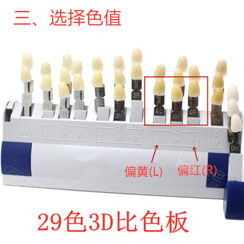 告诉你全瓷牙几号颜色好看!
