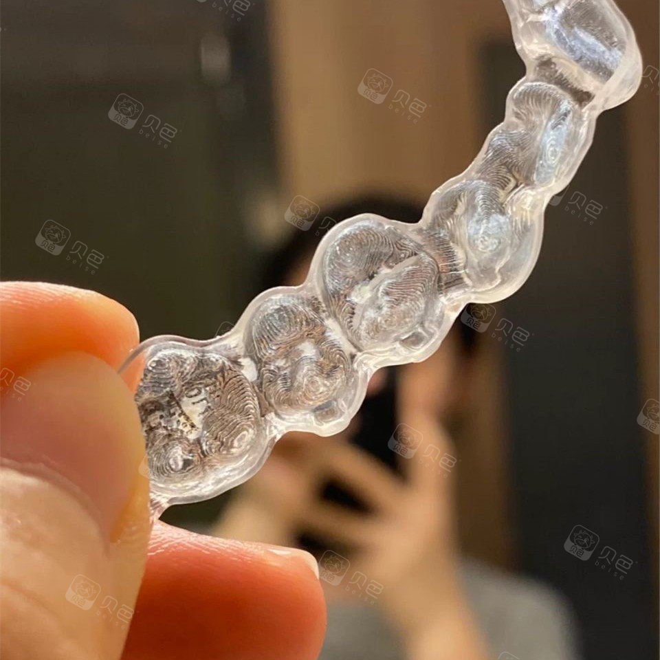 透明牙套一点也不丑