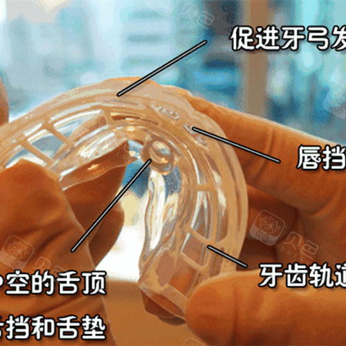 后悔死了早知道就让孩子mrc早期干预了,也不用遭这罪 - 贝色口腔