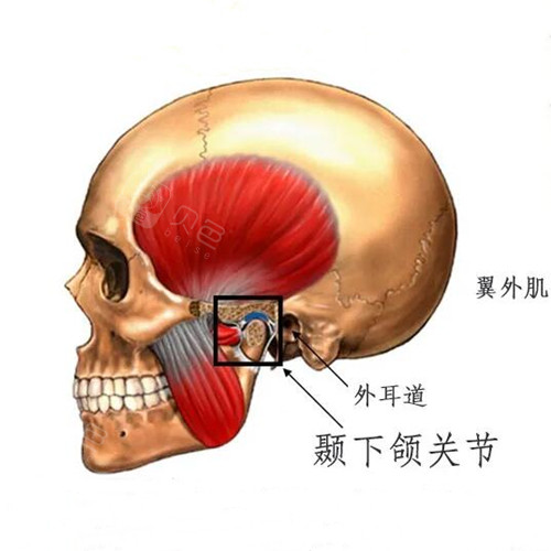 颞下颌关节紊乱能戴牙套吗