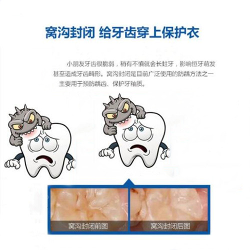 窝沟封闭的害处和好处是什么