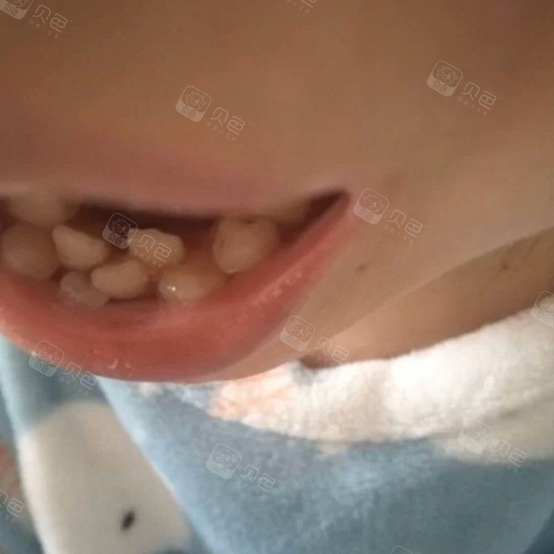 一口乱糟糟的牙齿