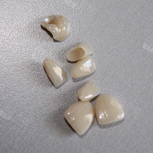 想知道牙冠戴多久能完全适应?看这里!