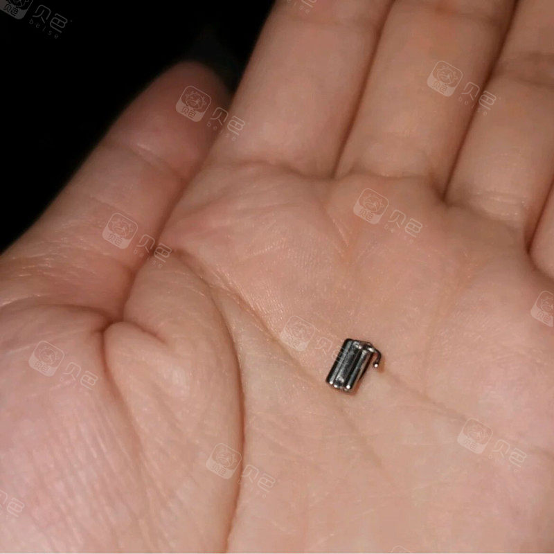 莫名其妙的托槽又掉了真的要再收我400吗?