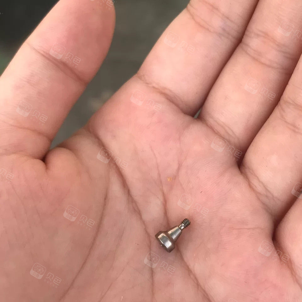 种植牙螺丝也能掉出来吓傻我了
