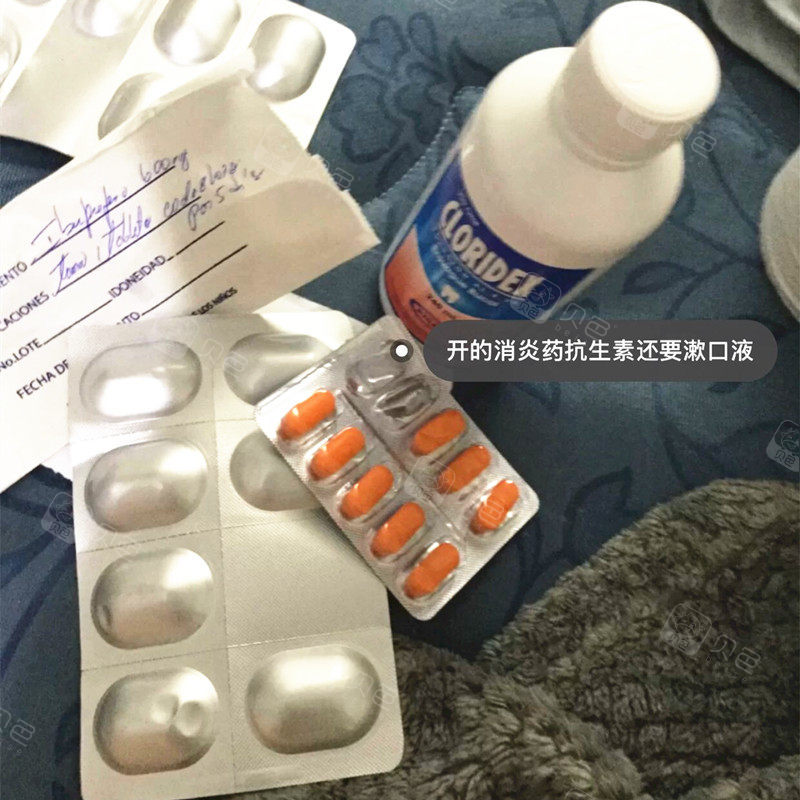 拔牙后开的消炎药