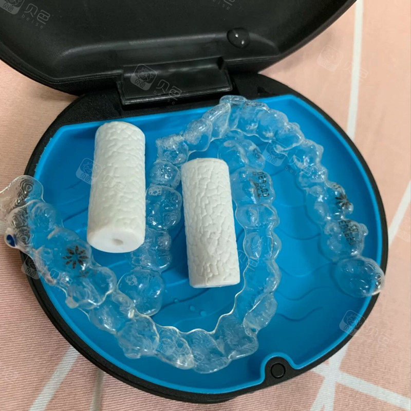 隐适美隐形矫正第一天感受以及后边感觉有点牙龈萎缩