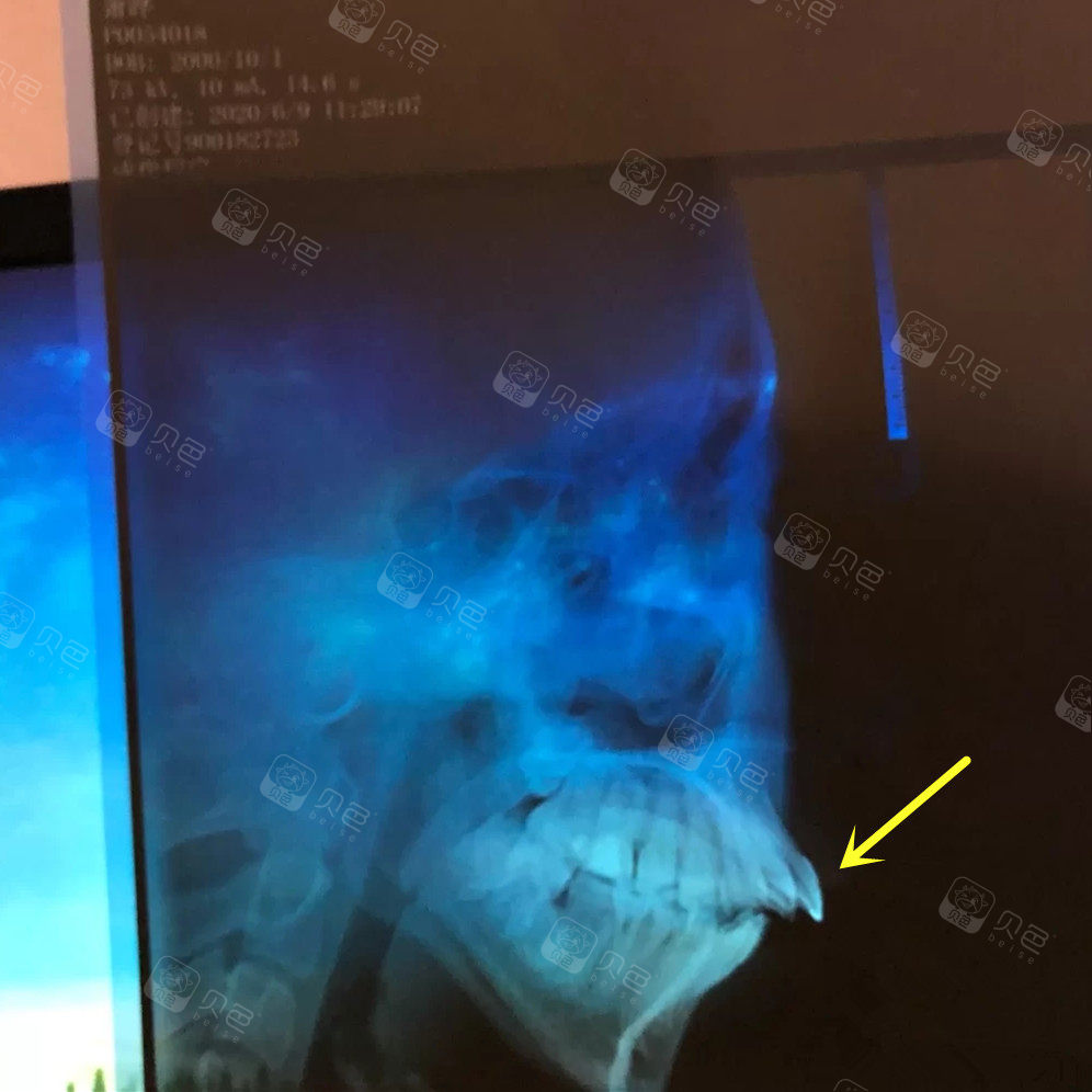 壹加壹咨询:骨性龅牙只能改善 牙齿咬合问题可以解决