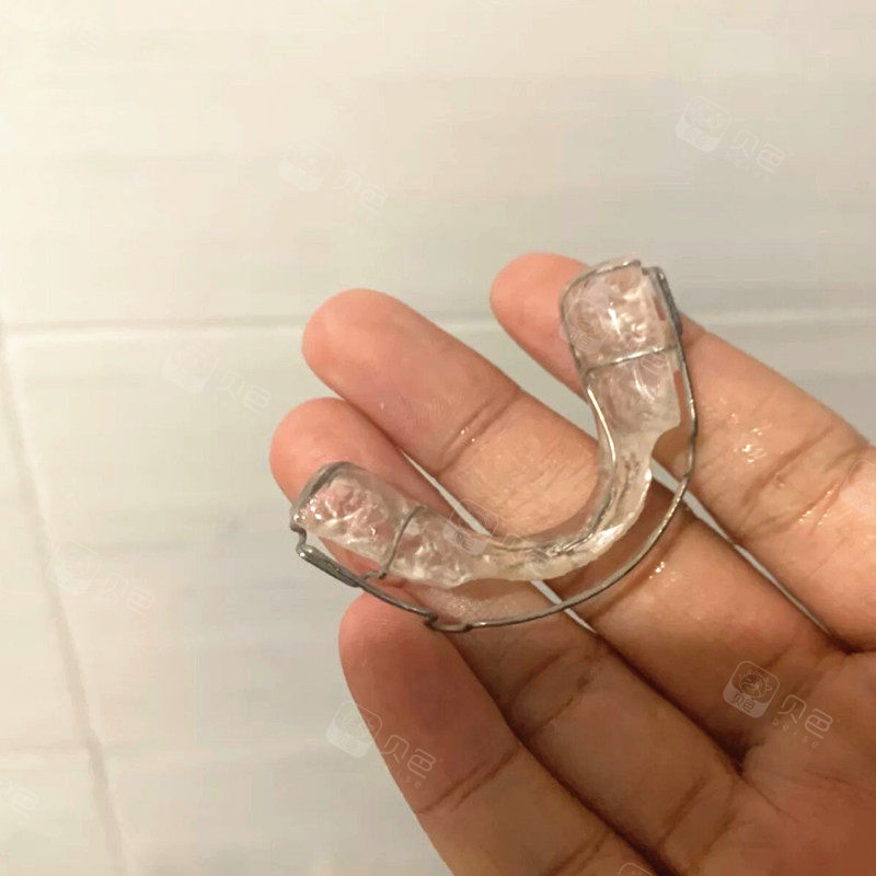 4岁孩子矫正遗传性地包天到底对还是错