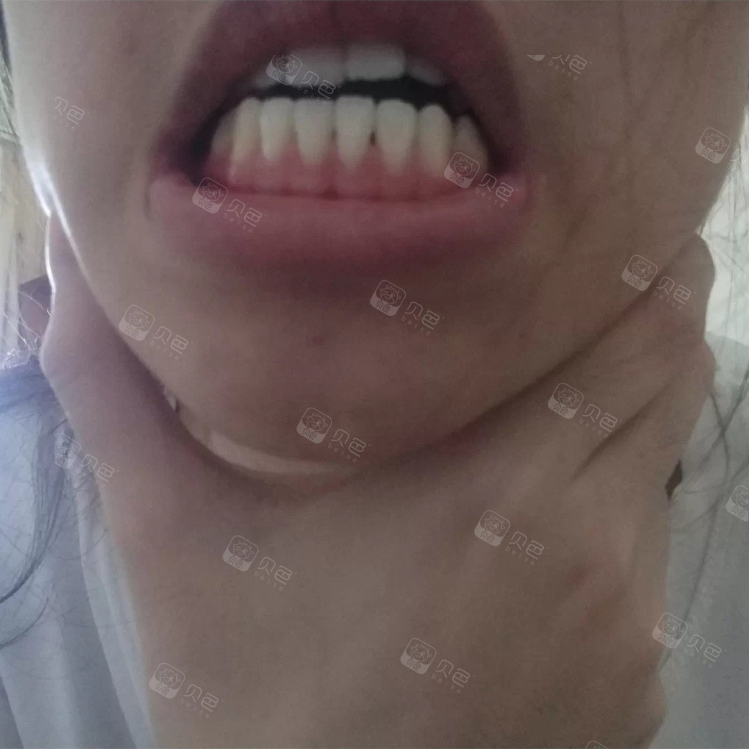 为了把牙齿刷干净 就要用大力?用硬毛?