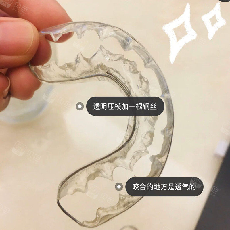 我可能是全网第一个po这款保持器的牙套妹妹吧