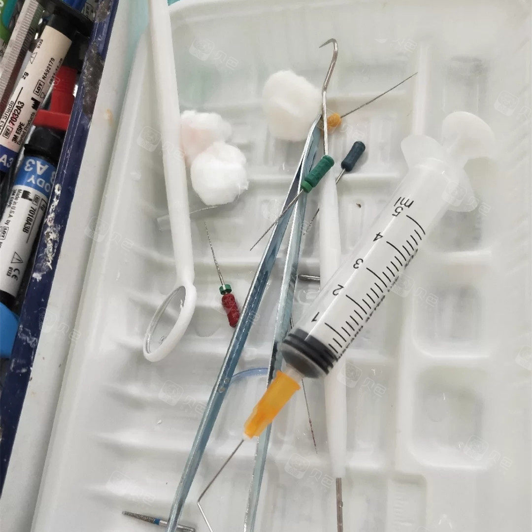 惨痛历经磨难的一天:根管治疗详细过程