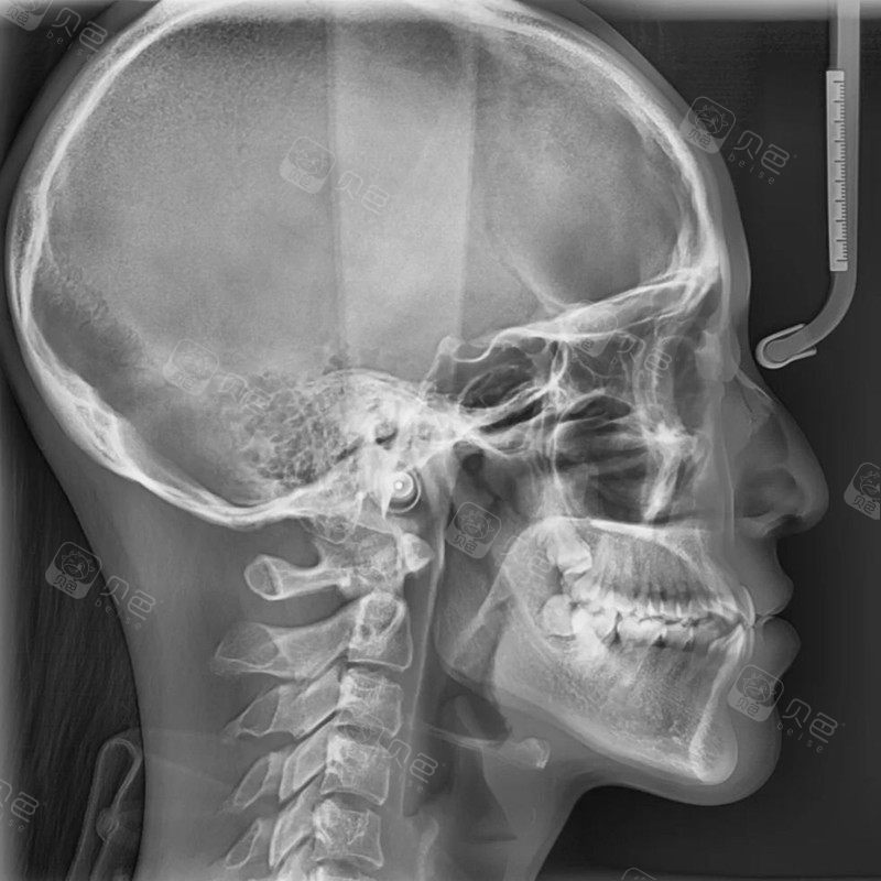 逛社区 >  牙友讨论 >  详细页面参考金额  0元 口腔项目  牙齿矫正