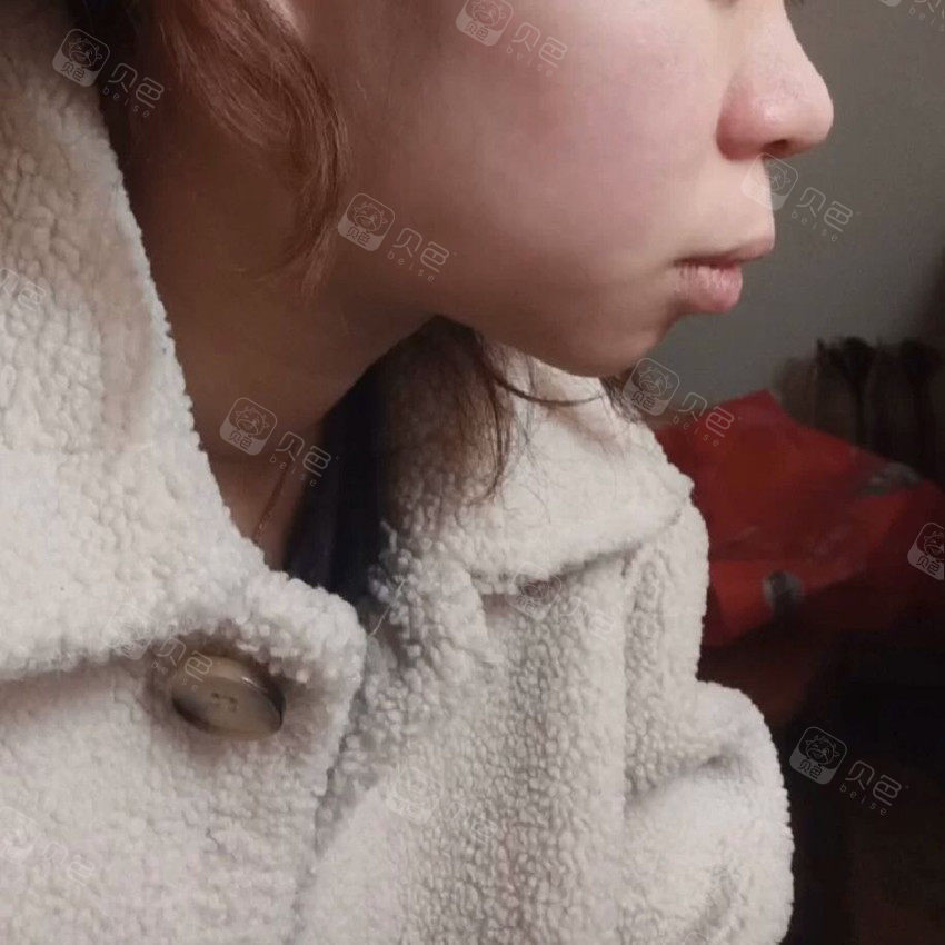 深圳弘瑞口腔告诉你啥样的牙齿问题能通过矫正能改变脸型