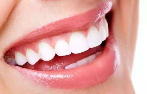 洁白整齐的牙齿