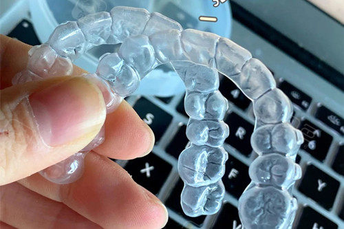 为自己的大意买单,进行第二次牙齿矫正 - 贝色口腔