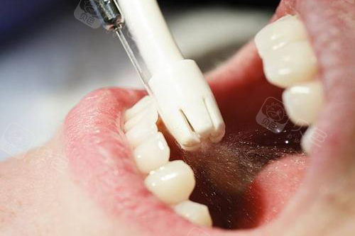 300米路西瑞士ems舒适洁牙:200 南阳康泽口腔采用瑞士ems喷砂洁牙机