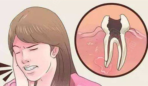 分享三十岁的我长了四颗智齿拔牙的经历(一)