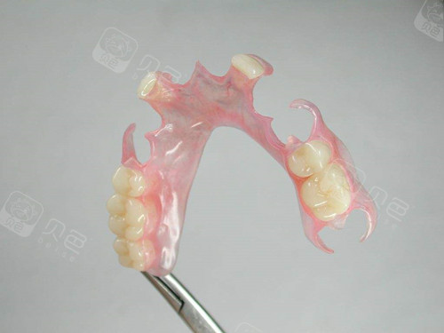 种植牙相比活动假牙有什么优势?