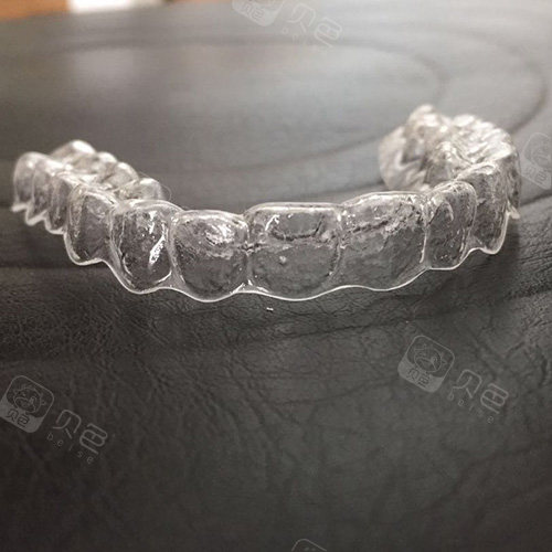 苏州带隐形牙套多少钱这份矫正牙套价格表你一定需要