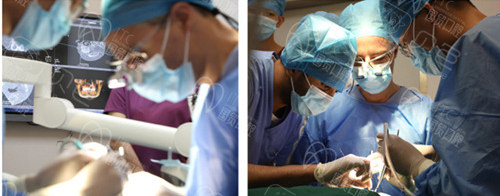 牙瘤切除术 恒牙阻生牵引正畸手术治疗过程图