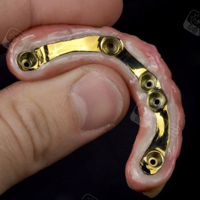 为什么有人说千万不要戴活动假牙?