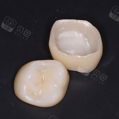 你知道合肥全瓷牙冠价格多少钱一颗吗价格大全在这里