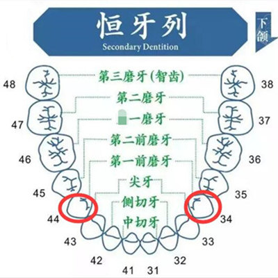 我听有人说拔掉四颗牙齿矫正后悔! - 贝色口腔