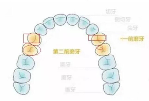 正畸拔牙4颗有危险吗我听有人说拔掉四颗牙齿矫正后悔
