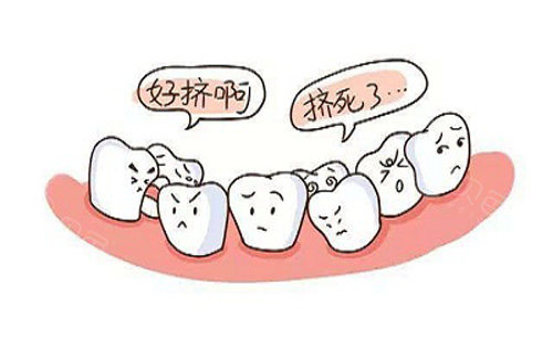 牙齿拥挤不堪