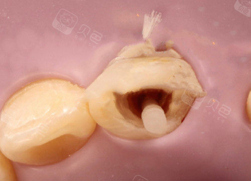 重庆乐乐欣口腔牙医段斌,儿童牙齿畸形矫正惨痛案例!