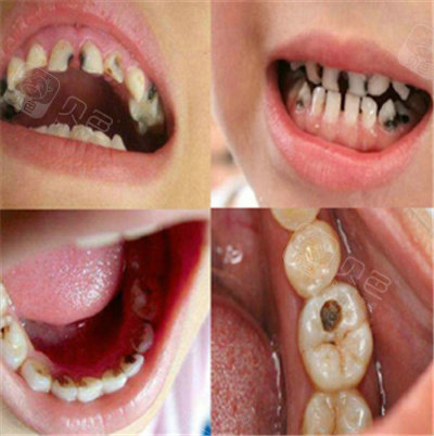 南川牙科收费价目表公开