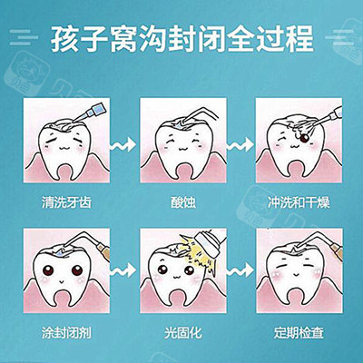 儿童窝沟封闭过程