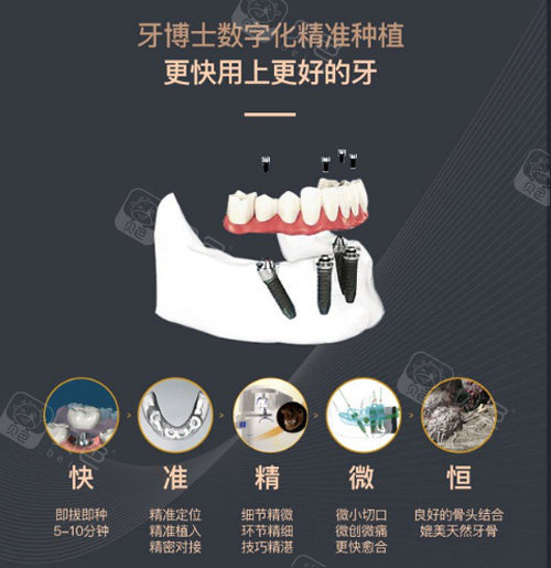 牙博士口腔种植牙优势