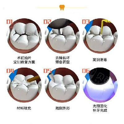 咸阳补牙哪家牙科好?能用医保吗?公布正规牙科医院补牙价格