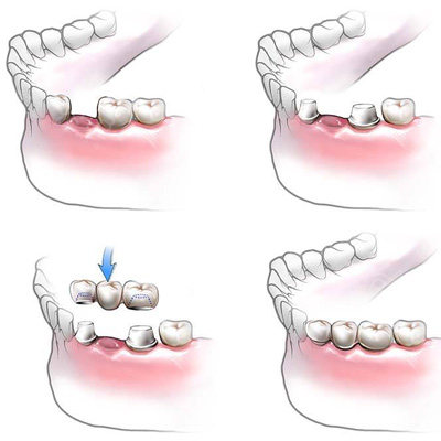 烟台镶牙哪家医院好?了解一下各家专业牙科医院特色!