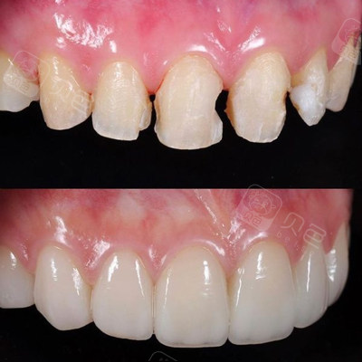 创美口腔虽然门店不是很大,但是口腔诊疗技术确实收获了不少牙友的