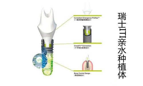 瑞士iti亲水种植体