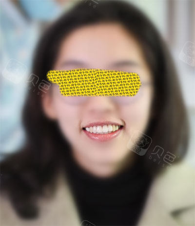 门牙换全瓷牙后我感受"异物感"很强,不知道有没有同感