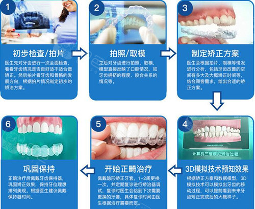 另外,医院也推出了牙齿矫正数码初查设计套餐,仅88元左右,就能体验