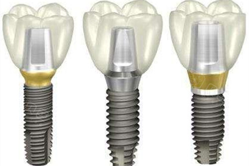 韩国登腾种植体图示