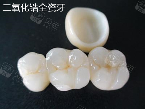 二氧化锆全瓷牙